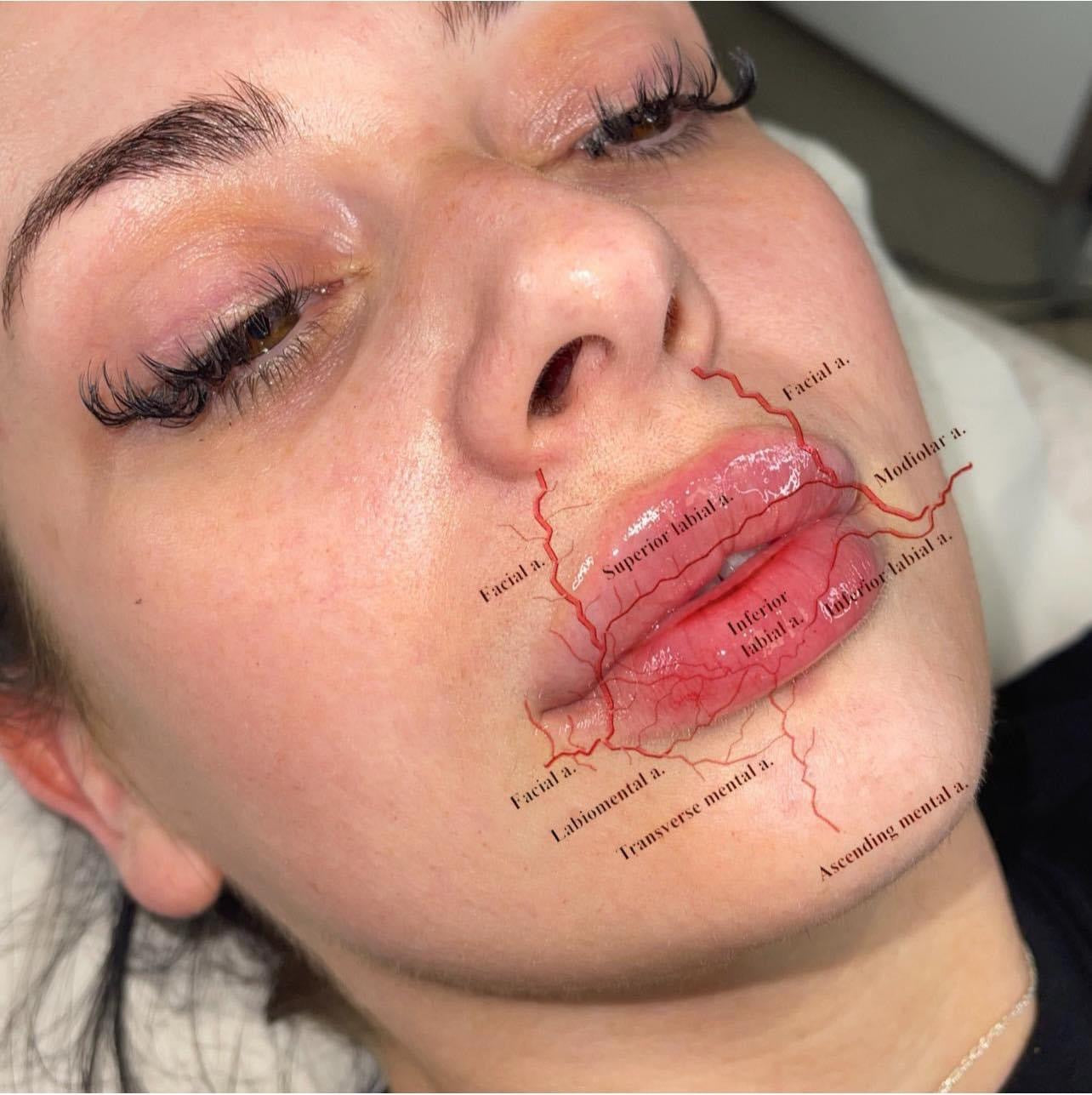 Lip anatomy veins in the lips